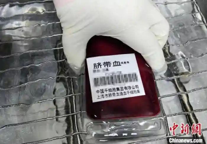 中新健康丨小宝脐血救大宝 上海脐血库联合苏州儿童医院完成造血干细胞移植