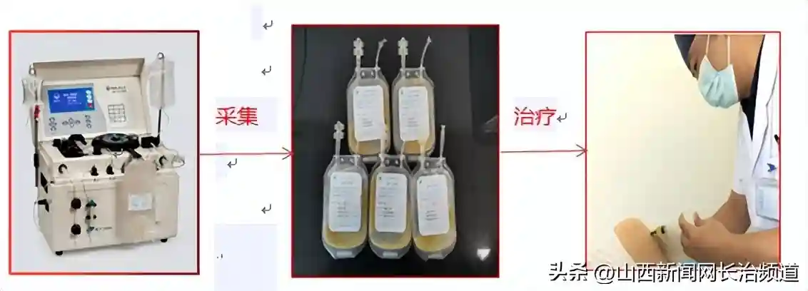 长治北大医疗潞安医院：输血科血液分离技术已取得突破性进展