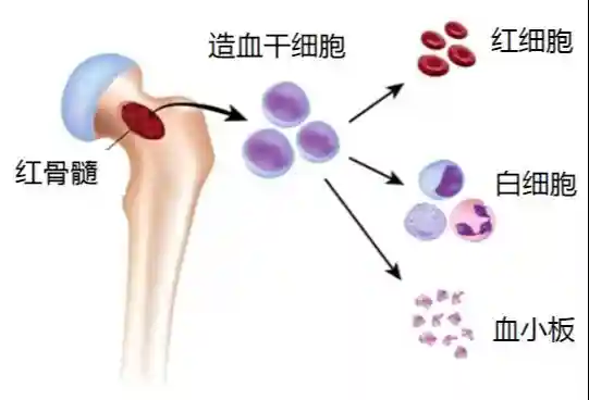 体检发现脾脏肿大，警惕“中招”骨髓纤维化
