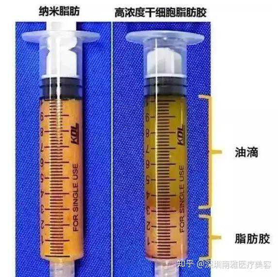 “从没想过自己能成为‘幸运儿’！”余文鑫，你太帅了！