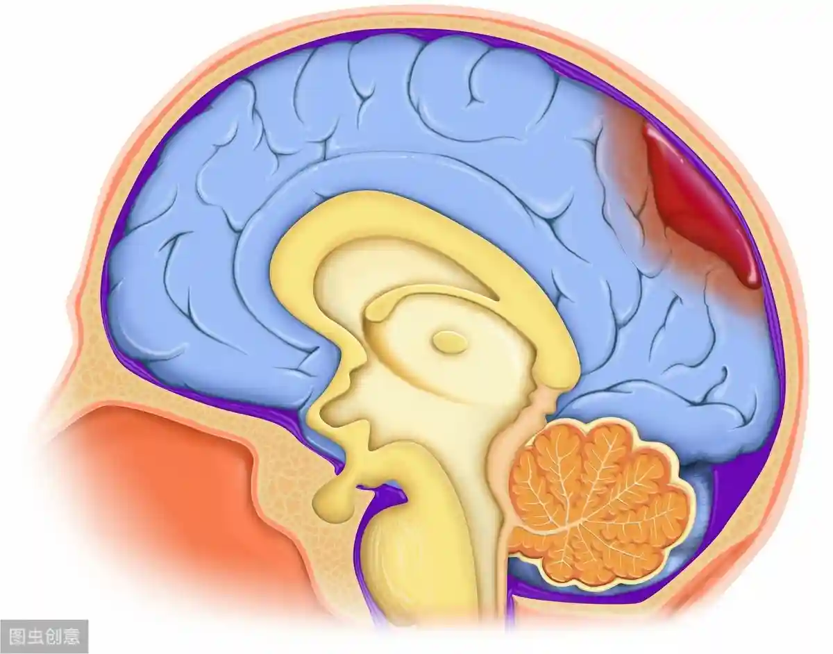 信阳师范学院许军旗教授因脑干出血逝世，年仅41岁，病因是它