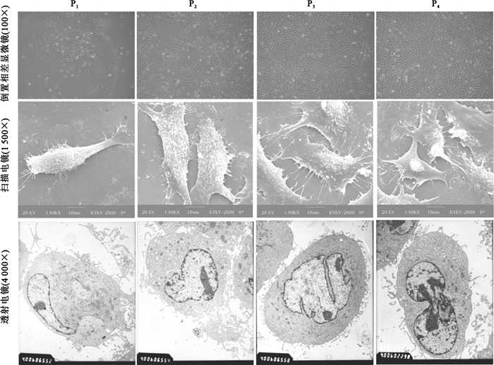 干细胞干预脑出血后遗症安全有效